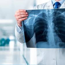 Imagen de estudios de radiologia